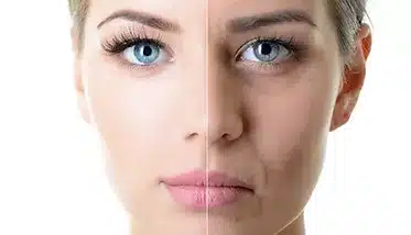 dermal-fillers-oakville